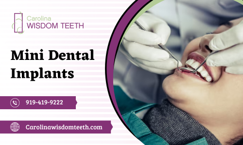 Our super-trained surgeons are here to facilitate your oral surgery through a comprehensive range of cutting-edge procedures. Contact us now - 919-419-9222.