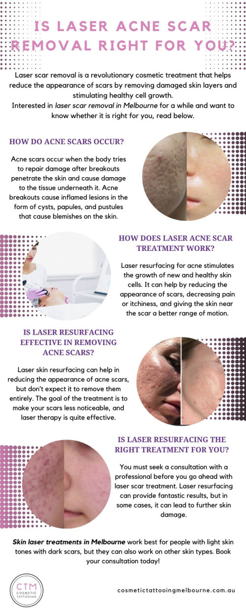 Laser scar removal, also known as laser resurfacing, is a revolutionary cosmetic treatment that helps reduce the appearance of scars by removing damaged skin layers and stimulating healthy cell growth. If you have been interested in laser scar removal in Melbourne for a while and want to know whether it is right for you, you’ve come to the right place. Visit: https://cosmetictattooingmelbourne.com.au/scar-acne-laser-treatment/


#SkinlasertreatmentsMelbourne #laserscarremovalMelbourne #CosmeticTattooingMelbourne #cosmetictattooing