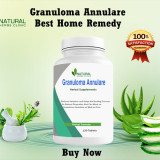 Natural-Remedies-for-Granuloma-Annulare