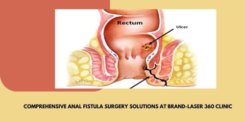 Seek effective anal fistula surgery at Brand-Laser 360 Clinic. Our experienced team utilizes advanced techniques to provide comprehensive and personalized solutions, ensuring optimal healing and long-term relief. Trust us for expert care and improved well-being.
https://laser360clinic.com/laser-fistula-treatment/