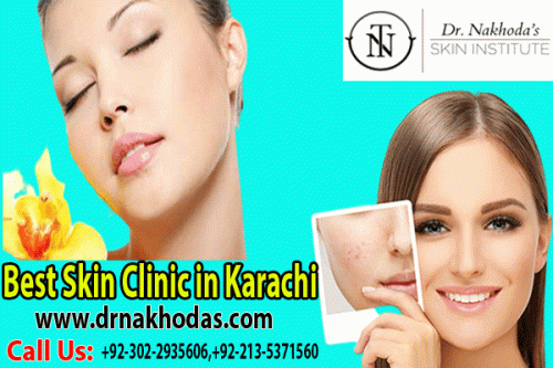 Best Skin Clinic in Karachi