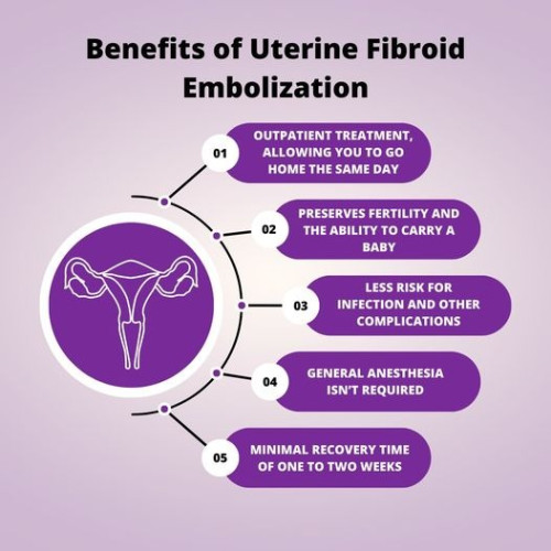Uterine Fibroid Embolization (UFE) is a minimally invasive procedure that provides many benefits over other treatment options. Explore more about UFE benefits

https://www.usafibroidcenters.com/uterine-fibroid-treatment/uterine-fibroid-embolization/