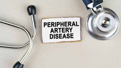 Unlocking the World of PAD Medical Terms: Enhance your Knowledge of Peripheral Artery Disease and Empower Communication with Healthcare Providers!