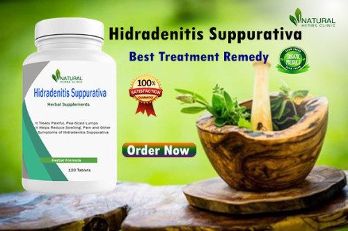 We will explore the top Herbal Remedies for Natural Relief for Hidradenitis Suppurativa and their potential benefits. https://www.natural-health-news.com/natural-relief-for-hidradenitis-suppurativa-top-6-herbal-remedies/
