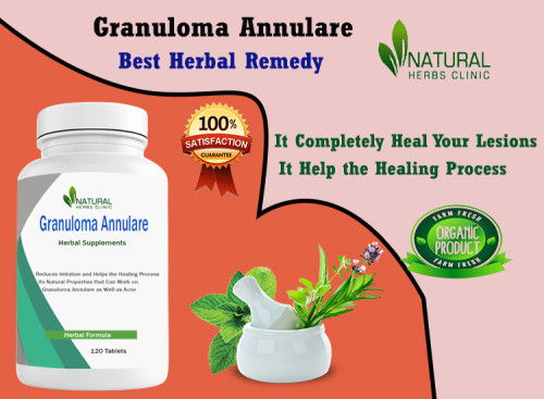 Granuloma Annulare at Home with natural remedies may offer several potential benefits. These remedies can provide a definitive recovery, they can help manage symptoms and promote healing process. https://telegra.ph/How-to-Treat-Granuloma-Annulare-at-Home-An-Evidence-Based-Approach-05-29