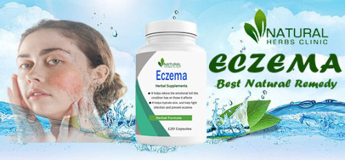 Looking for Natural Remedies for Eczema? Discover the most effective natural treatments and home remedies for eczema, from dietary changes to herbal lotions. Get relief from your skin condition today with our comprehensive guide. https://www.naturalherbsclinic.com/blog/natural-remedies-for-eczema-on-face-apply-easy-and-fast-way/