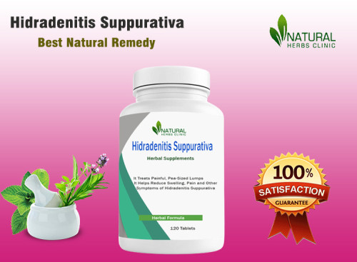 Hidradenitis Suppurativa Herbal Treatment