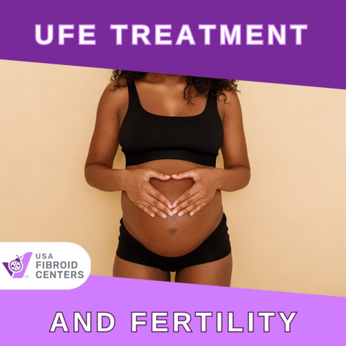 If you are considering fibroid treatment and want to get pregnant in the future, we recommend discussing the issue with one of our medical experts. We can help you understand all available fibroid treatments. Here is all you need to know about pregnancy after UFE treatment.

Read on-
https://www.usafibroidcenters.com/blog/pregnancy-after-uterine-fibroid-embolization/