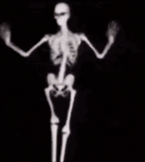 skeleton