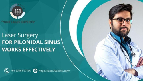 The laser treatment for pilonidal sinus takes around 30 to 45 minutes. There are some factors affecting the duration of the surgery.
https://laser360clinic.com/laser-surgery-for-pilonidal-sinus-works-effectively/