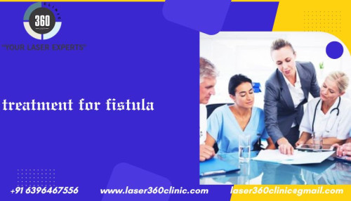 The laser treatment is proving to be the greatest for a quicker healing and discharge procedure as a result of this innovative treatment for fistula.
https://laser360clinic.com/how-it-feel-like-living-with-a-fistula/