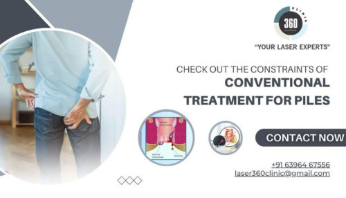 For a successful and satisfying piles treatment, it is preferable to use laser treatment over uncomfortable and painful conventional treatments.
https://laser360clinic.com/check-out-the-constraints-of-conventional-treatment-for-piles/